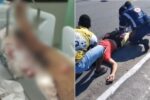 motociclista-passa-a-usar-fraldas-apos-ser-arremessado-por-carro-na-contramao;-video